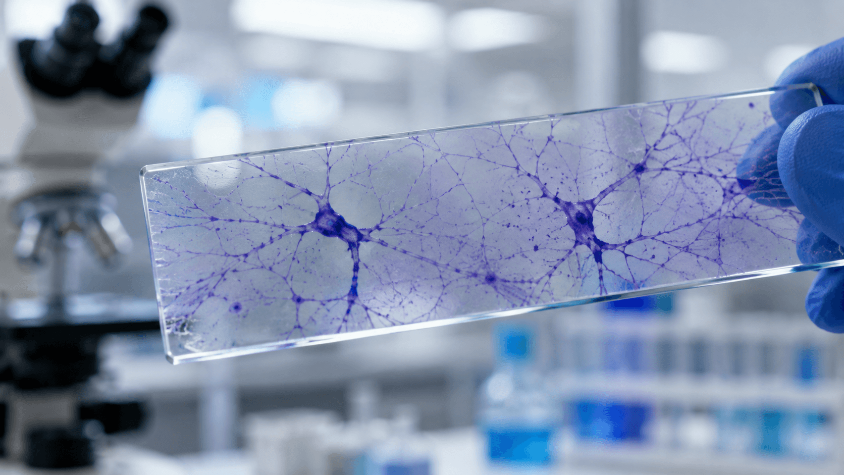 Multiple Sclerosis Market Forecasts Strong Growth to 2034